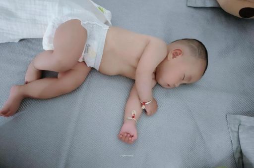 借卵生子机构宝宝褶皱处擦粉还是油